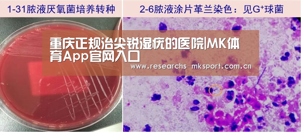 重庆正规治尖锐湿疣的医院|MK体育App官网入口 (图2) MK体育